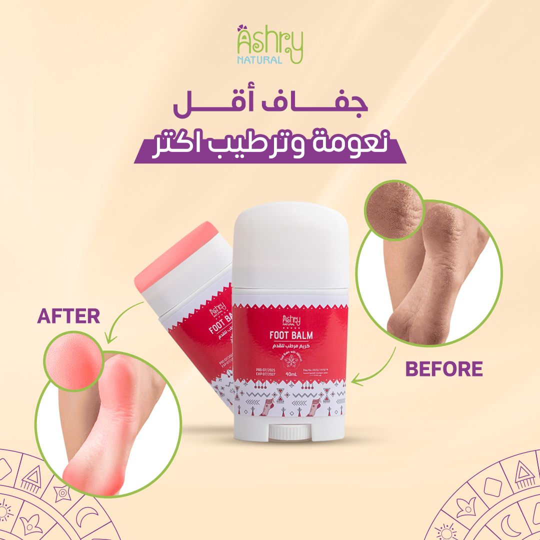 Foot balm