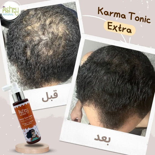 Karma Tonic extra