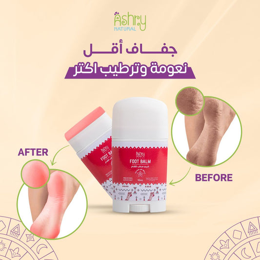 Foot balm