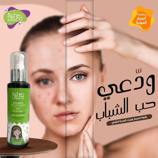Acne serum